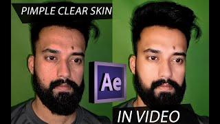 Removing Pimples in After Effects without Plugins