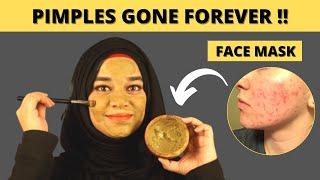 PIMPLE SOLUTION - NEEM FACE MASK | 100% Results !! Magic Drink for Glowing Skin | Ramsha Sultan