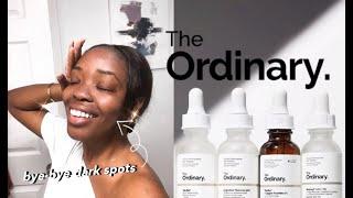 The Ordinary - 5 BEST Products for Hyperpigmentation, Dark Spots, Oily + Acne-Prone Skin 2020