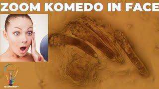 SHOCKING‼️ ZOOM KOMEDO IN FACE‼️ #zoom #microscope #acne #blackheads #satisfying #satisfyingvideo