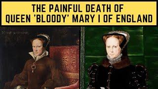 The PAINFUL Death Of Queen 'Bloody' Mary I Of England