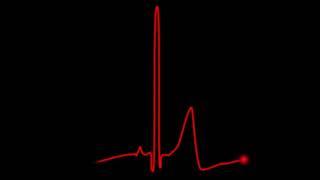 heartbeat black screen effect | black screen | II MDA