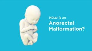 What Are Anorectal Malformations?