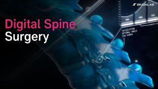 Digital Spine Surgery - Closing the loop