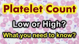 Platelet count | Thrombocytopenia (Low platelet count) and Thrombocytosis (high platelet count)