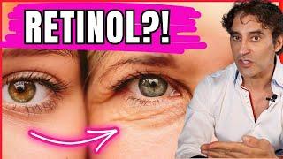 IS YOUR RETINOL AGING AND DAMAGING YOUR EYES ??