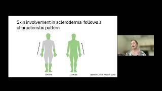 Blum Center Program: Scleroderma - Symptoms, Diagnosis, and Treatments