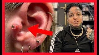 PIERCING BUMP Treatment ️ What is Keloid ⁉️ Everything You Need To Know