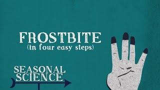 Frostbite | Seasonal Science | UNC-TV