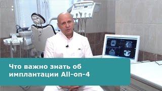 Что важно знать об All-on-4