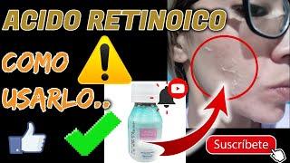 Acido Retinoico Como Usarlo, Acido Retinoico Para Que Sirve, Antes y Después, Recomendaciones..