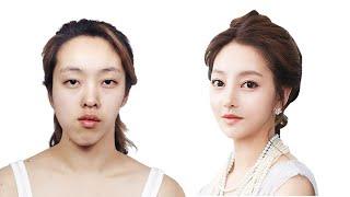 Top 5 Drastic Korean Plastic Surgery TV Show Transformations | Seoul Guide Medical