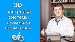 3D настройка с визуализацией электродов системы кохлеарной имплантации