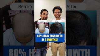 80% Hair Regrowth in 6 Months! | Hair Loss | Hair Tips | Adon Hair Care #viralvideo