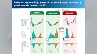 Spanish Translation: Recommendations for the Evaluation of LV Diastolic Function by Echocardiography