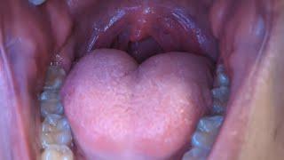 Mouth Tour and uvula