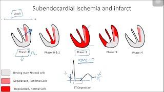 ST Elevation and Depression: Electrophysiological Basis