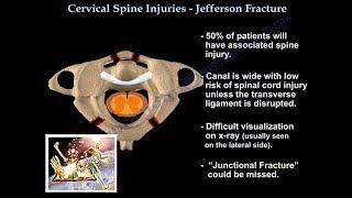 Jefferson Fracture - Everything You Need To Know - Dr. Nabil Ebraheim