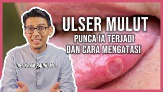 4 Cara Hilangkan Ulser Mulut. Bagaimana Ulser Terjadi : Bibir, Lelangit, Mulut dan Lidah.