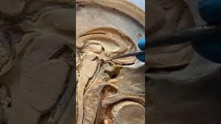 REAL Human Pituitary Gland and Stalk