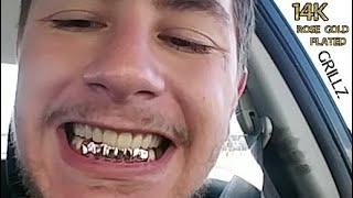 14K Rose Gold Plated Grillz Six Bottom Teeth Premade Grills