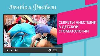  Секреты анестезии в детской стоматологии