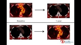 6th Annual TMII Symposium - 2016 - Session IV - Cardiovascular Imaging - Joseph  Lerman