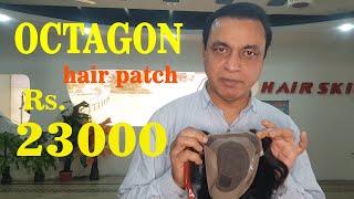 octagon hair patch in pakistan with lowest price |hair skill|