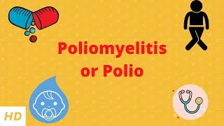 Poliomyelitis or polio, Causes, Signs and Symptoms, Diagnosis and Treatment.