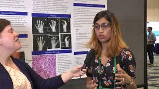 Dr. Sheetal Patel at RWCS 2018, Poster Presentation