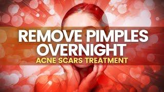 Skin Regeneration Rife Frequency | Remove Pimples Overnight | Acne Scars Treatment |  Monaural Beats