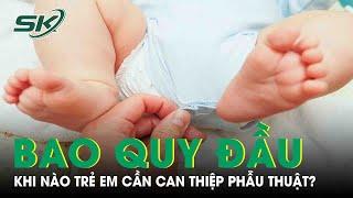 Hẹp Bao Quy Đầu Trẻ Em Qua Từng Giai Đoạn: Khi Nào Cần Phẫu Thuật? | SKĐS