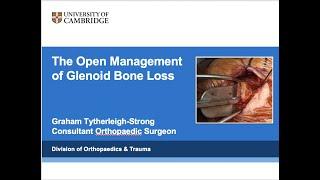 The Open Surgical Management of Glenoid Bone Loss