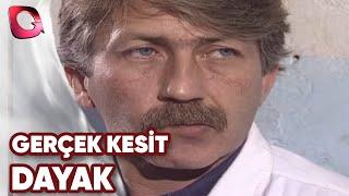 GERÇEK KESİT - DAYAK