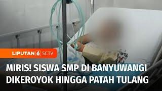 Seorang Siswa SMP di Banyuwangi Jadi Korban Aniaya Rekan Sekolah hingga Jalani Operasi | Liputan 6