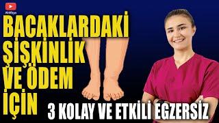 BACAKLARDAKİ ÖDEM VE ŞİŞKİNLİK TEDAVİSİ (Çok Kolay ve Etkili Egzersizler)