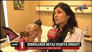 Bebeklerde Beyaz Dışkıya Dikkat!