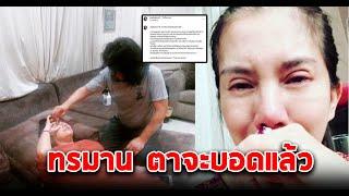 อาการล่าสุด กานต์ วิภากร ตาเริ่มมองไม่เห็นแล้ว #siamnews