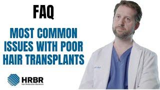 FAQ: Most common issues with hair transplants - Hair Restoration Blackrock