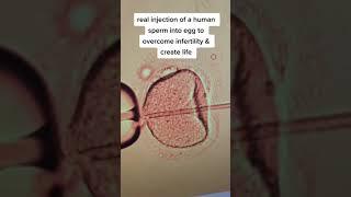 Real injection of sperm into a human egg to create a new life