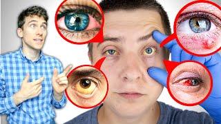 9 Maneras en que tus OJOS te Informan sobre tu Salud