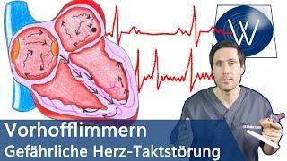 Vorhofflimmern: Wenn Ihr Herz den Takt verliert! Ursachen, Therapie & lebensgefährliche Folgen