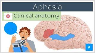 Aphasia: Wernicke's vs Broca's - Clinical Anatomy | Kenhub