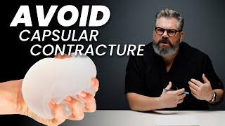 How to Avoid Capsular Contracture
