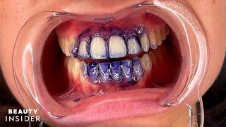 Purple Teeth Stains Can Temporarily Brighten Yellow Stains | Beauty Insider