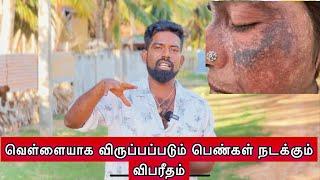 வெள்ளையாக விருப்பப்படும் பெண்கள் நடக்கும் விபரீதம் dk karththik dkvanni