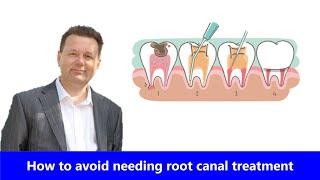 How to avoid needing root canal treatment & tips for healthy teeth