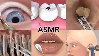 Care Animation Collection 2(no music) Eye, cavity,lip, ear Care | 케어 애니메이션 모음집2 | 눈, 치아, 귀, 입술