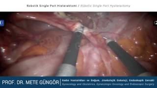 Robotik Single Port Histerektomi / Robotic Single Port Hysterectomy