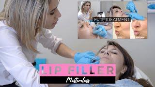 Natural Looking and Beautiful Lips | Dermal Filler Training Masterclass